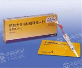 国产戈舍瑞林微球操作视频